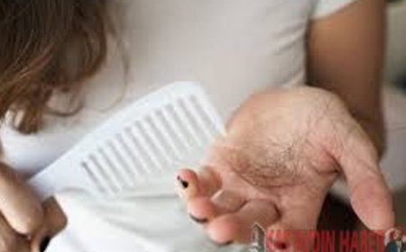 SAÇ DÖKÜLMESİNİN SEBEBİ BUYMUŞ!